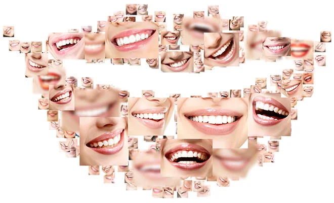 Cyfrowe projektowanie uśmiechu (DSD)