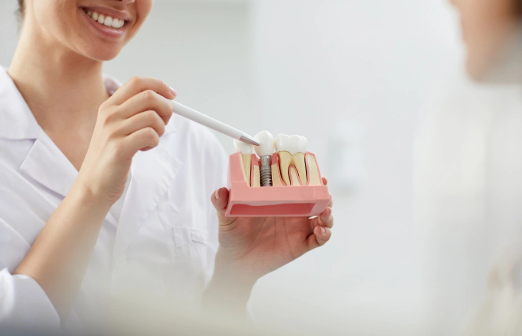 Pani dentystka pokazująca pacjentowi jak wygląda implant zęba na modelu