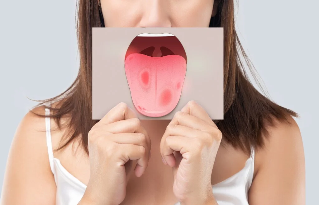 kobieta trzyma obrazek zasłaniający usta. Na obrazku widać wystający język ze zmianami na nim i nieświeżym oddechem