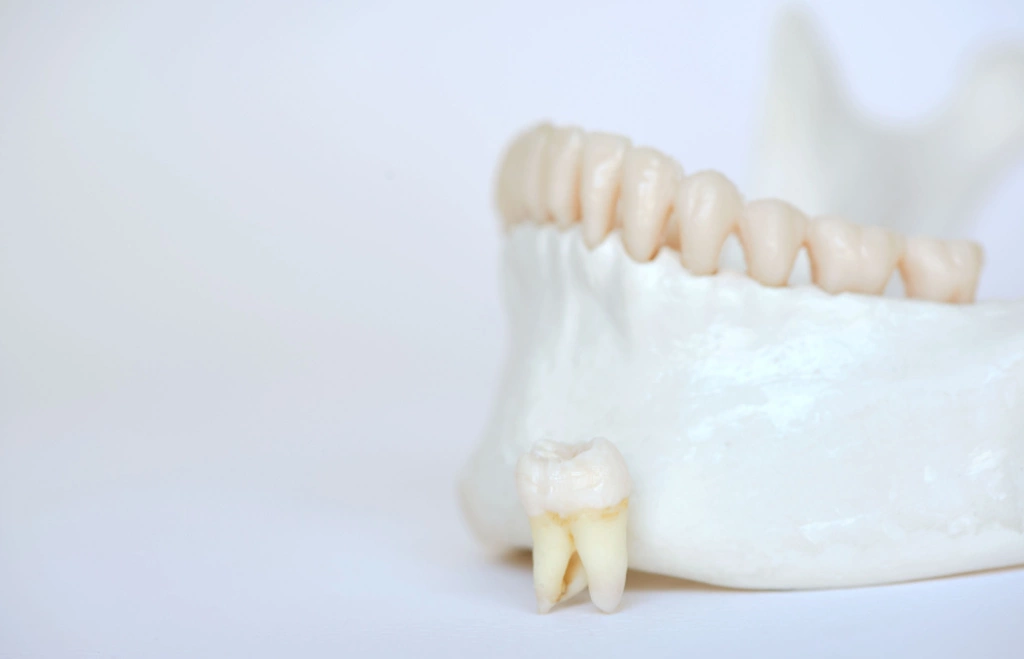 Ząb trzonowy obok modelu szczęki z zębami na białym tle