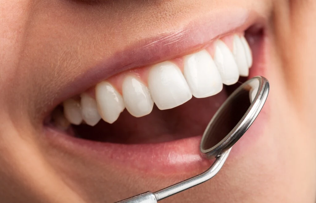 Górne zęby w uśmiechu z przyłożonym lusterkiem stomatologicznym
