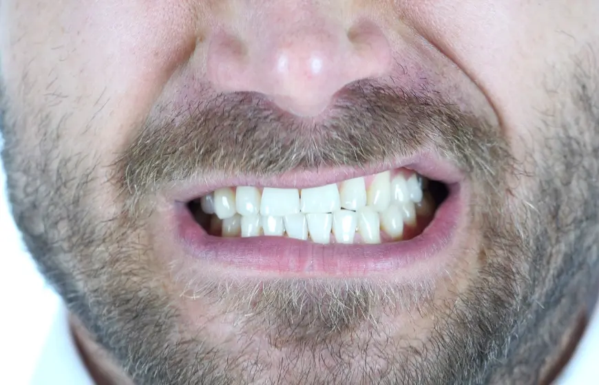 Mężczyzna, który cierpi na briksizm i mocno zaciska zęby i zgrzyta zębami