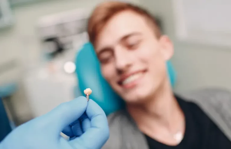Implant zęba cena. Kompletny przewodnik.