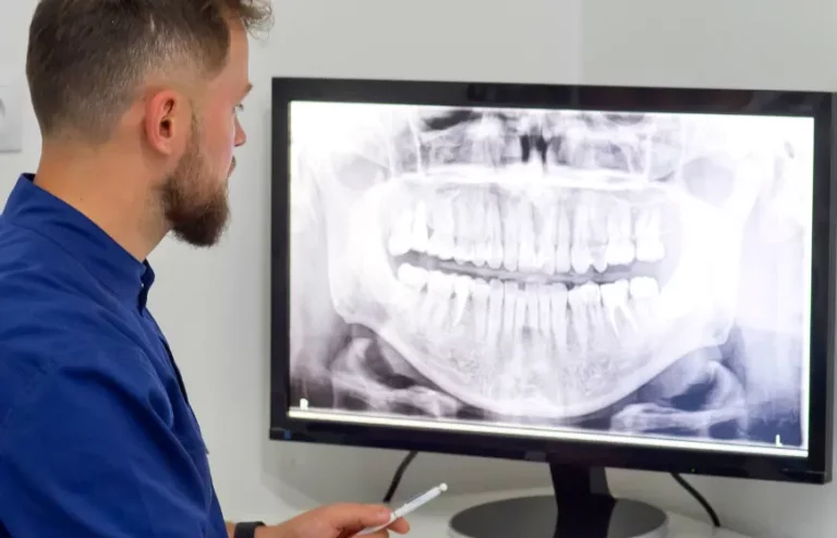 Badanie pantomograficzne zębów – o czym powinien wiedzieć każdy pacjent?
