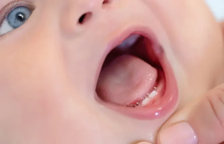 Przedwczesne, późne i wczesne ząbkowanie u niemowląt: Wszystko, co musisz wiedzieć