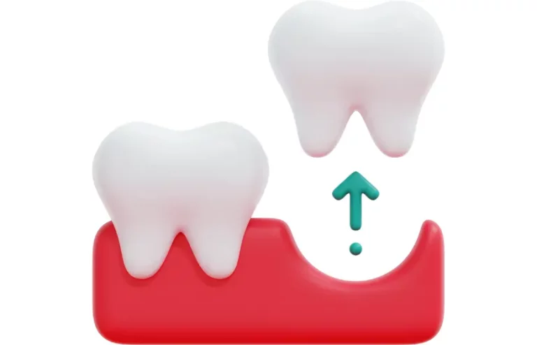 Dziąsło po wyrwaniu zęba – proces gojenia się rany