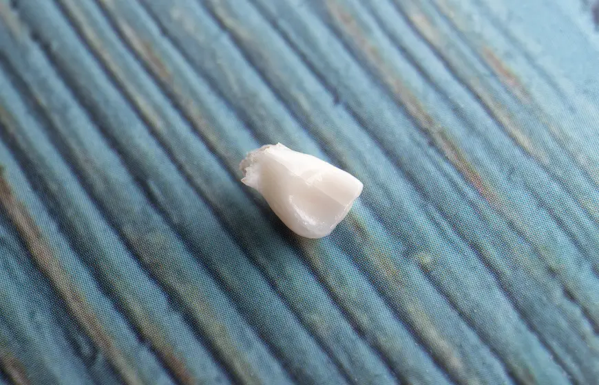 Fragment złamanego zęba z widocznym pęknięciem