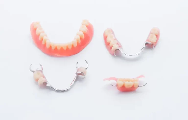 Protezy zębowe – czym są i jak wybrać najlepszą protezę zębową?