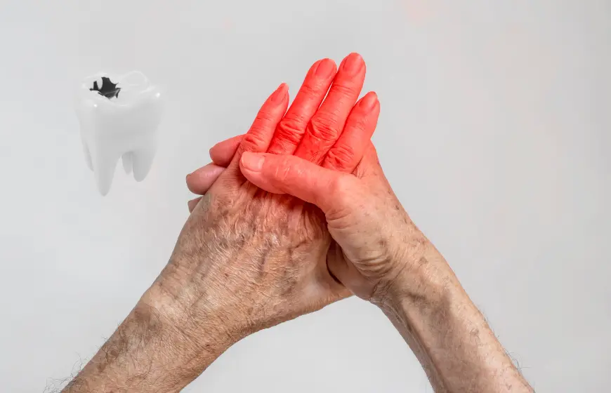 chore zeby choroby reumatyczne