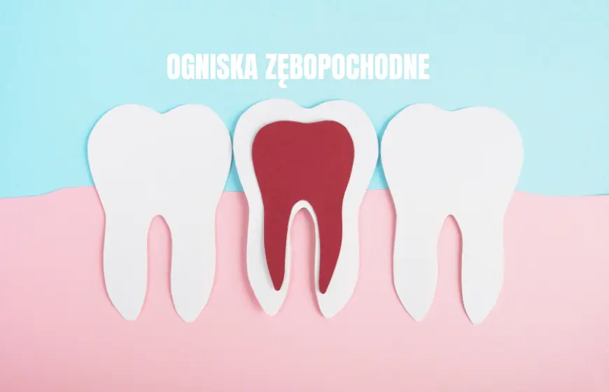 ognisko zebopochodne