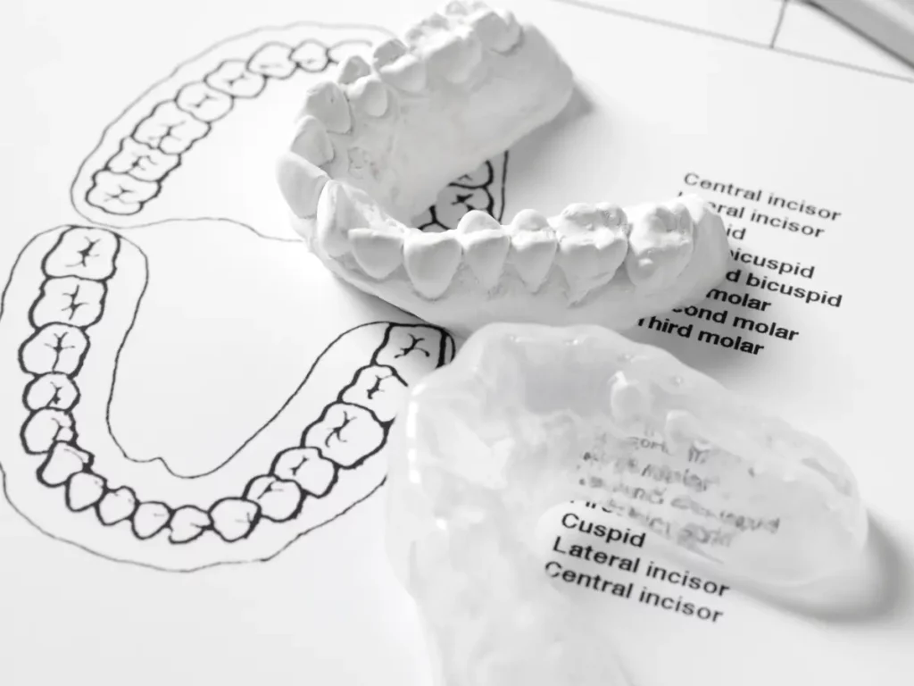 Diagram zębowy z modelami szczęki i nakładką dentystyczną – schemat numeracji zębów w stomatologii.
