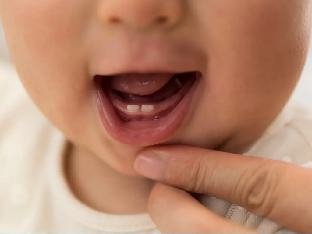 Niemowlę z pierwszymi zębami mlecznymi – zbliżenie na otwartą buzię dziecka podczas wyrzynania się dolnych siekaczy.