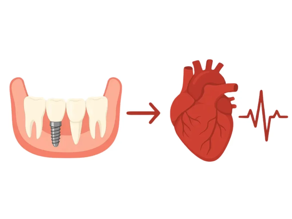 Implant w dolnej szczęce i serce z zapisem EKG – związek zdrowia jamy ustnej z układem krążenia