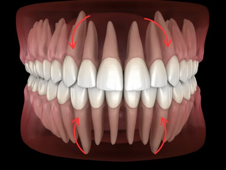 Zęby oczne – Kły. Rola, wyrzynanie i pielęgnacja