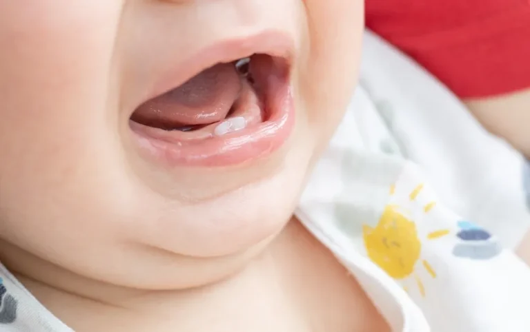 Kiedy pierwsze zęby – kompletny przewodnik dla rodziców