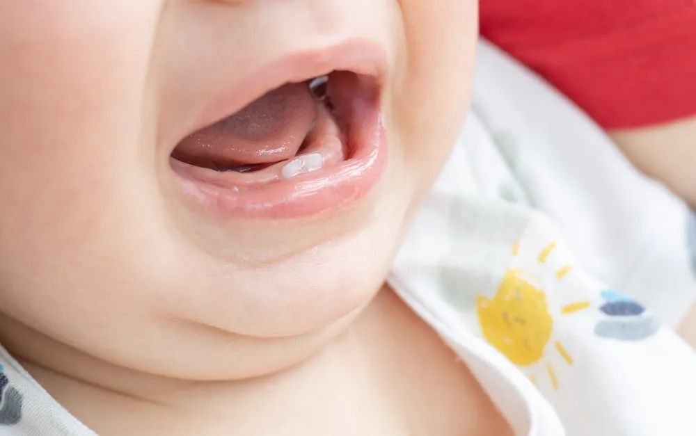 kiedy pierwsze zęby