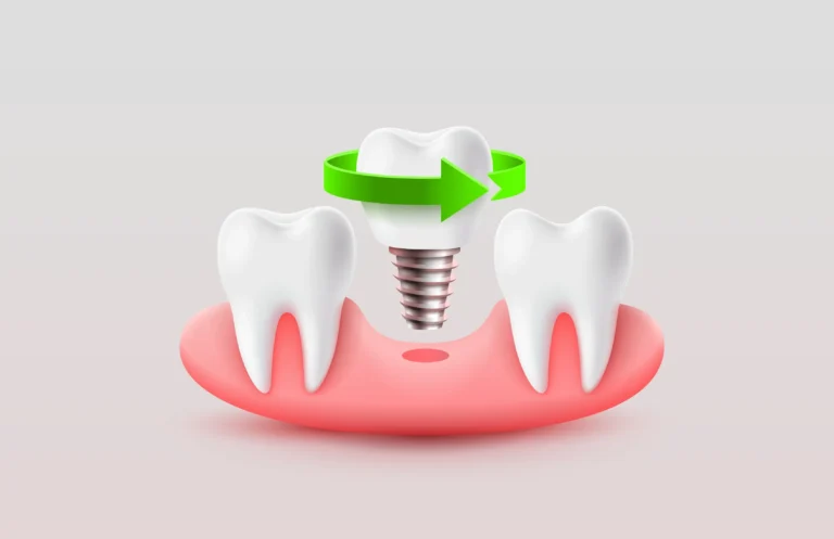 Jak dbać o implanty zębów? Sprawdzone metody i porady