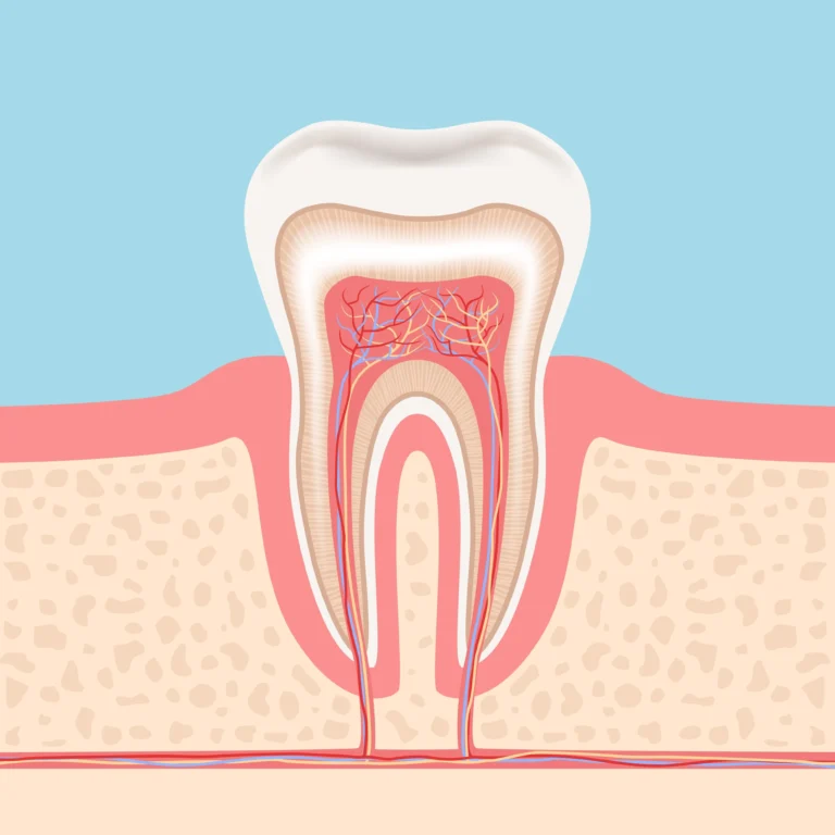 Obliteracja miazgi zęba – kompleksowy przewodnik kliniczny 2026
