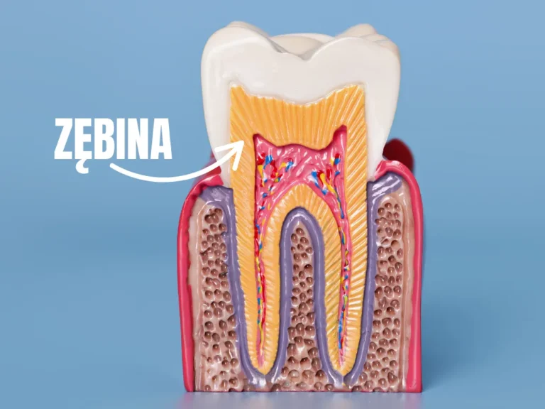 Nadwrażliwość zębów – kompletny przewodnik po przyczynach, objawach i leczeniu